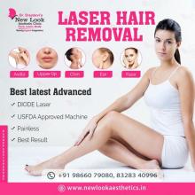 Laser hair removal Treatment in Hanamkonda